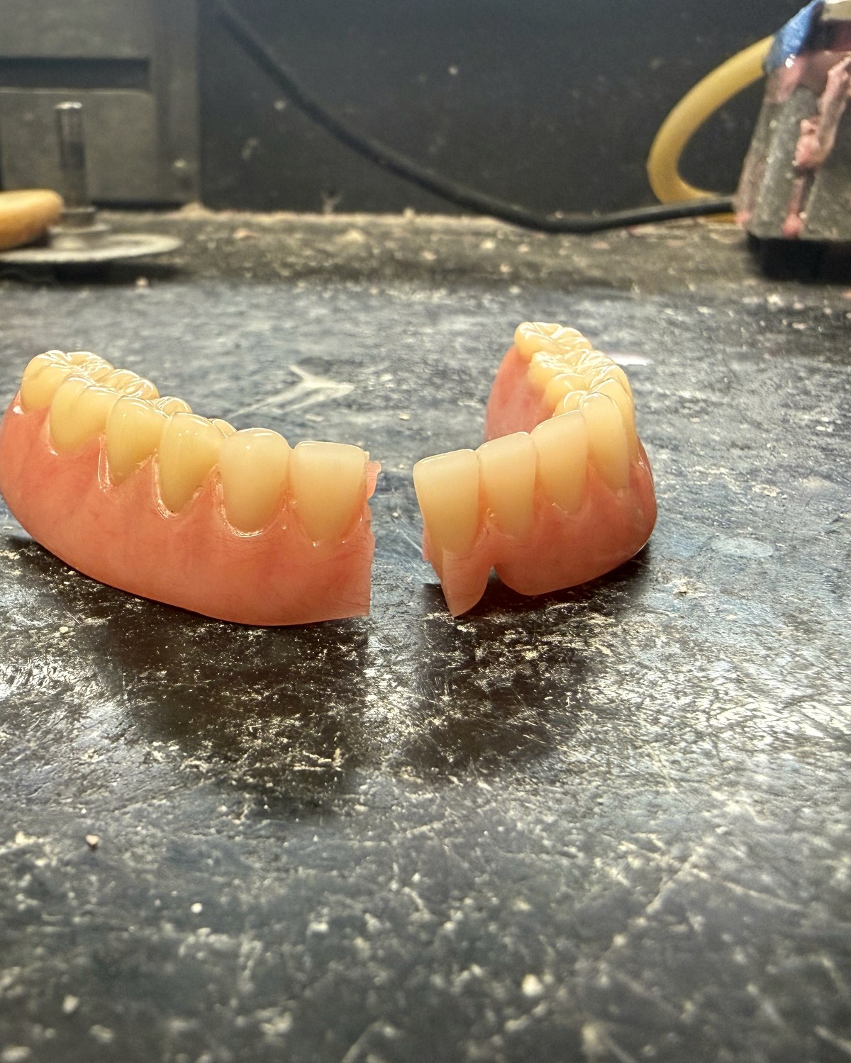 Before: full denture broken into two pieces
