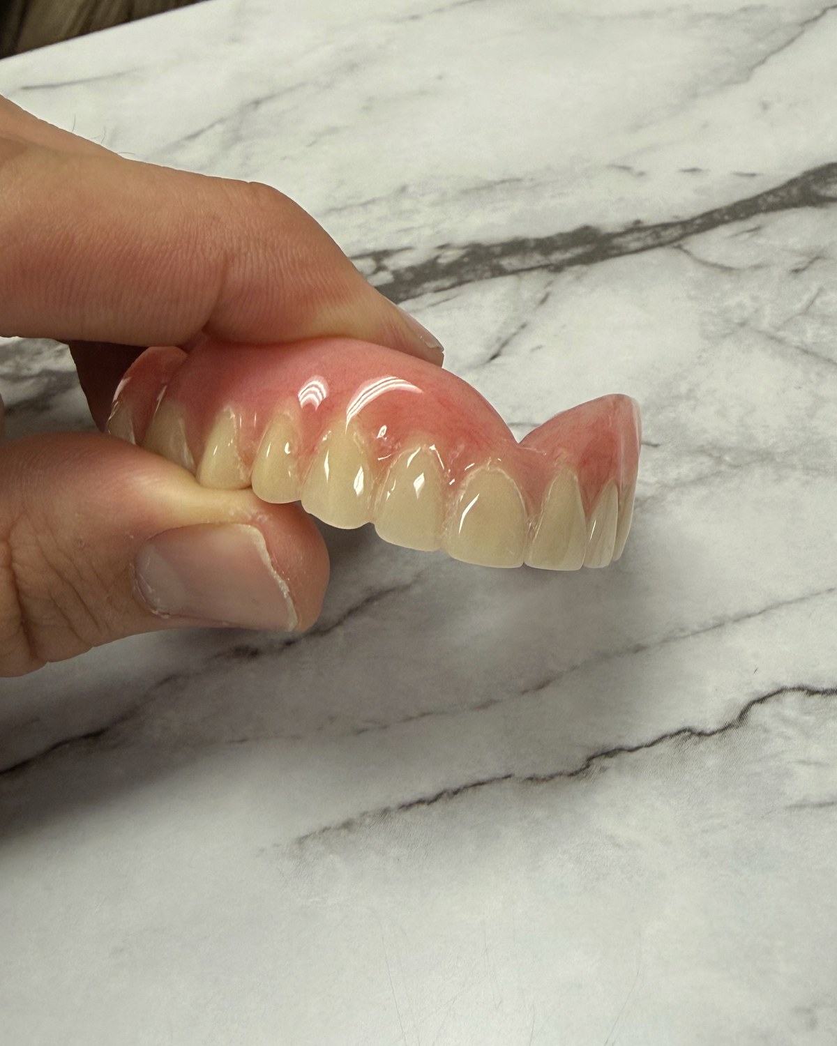 After: original intact tooth reset into the denture