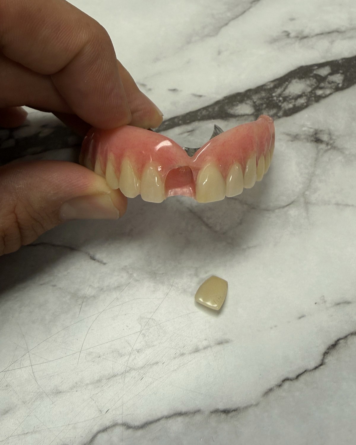 Before: intact denture tooth popped out