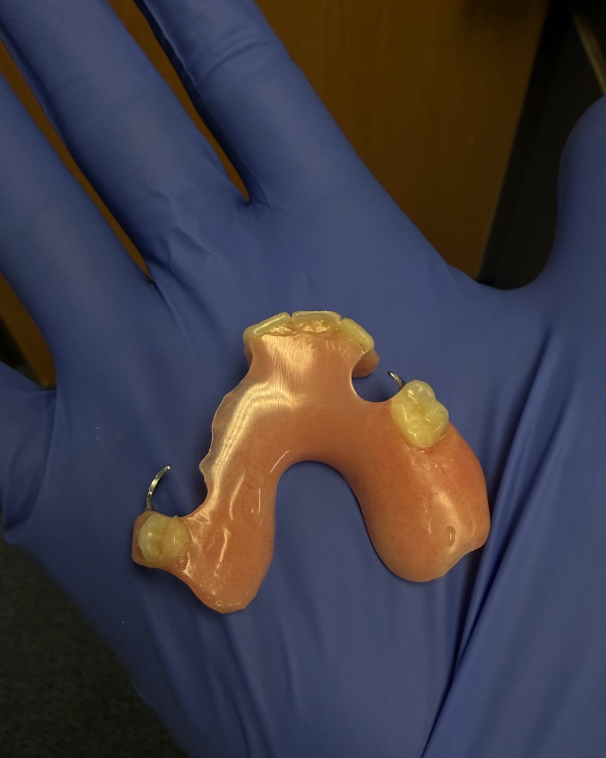 After: partial denture repaired