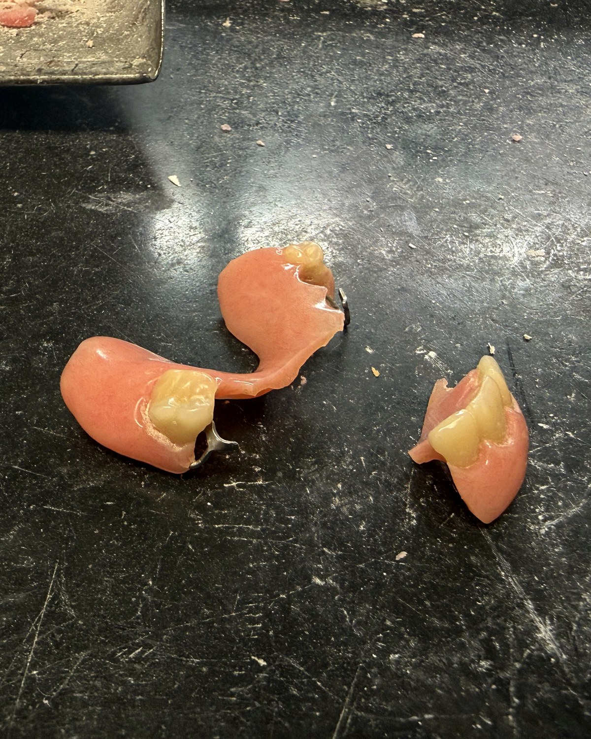 Before: partial denture broken into separate pieces